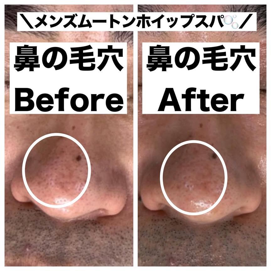 ムートンホイップスパ ビフォーアフター